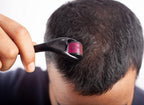 Rullo Viso 540 Micro Aghi 0.5mm – Anti-Rughe, Cellulite e Crescita Capelli
