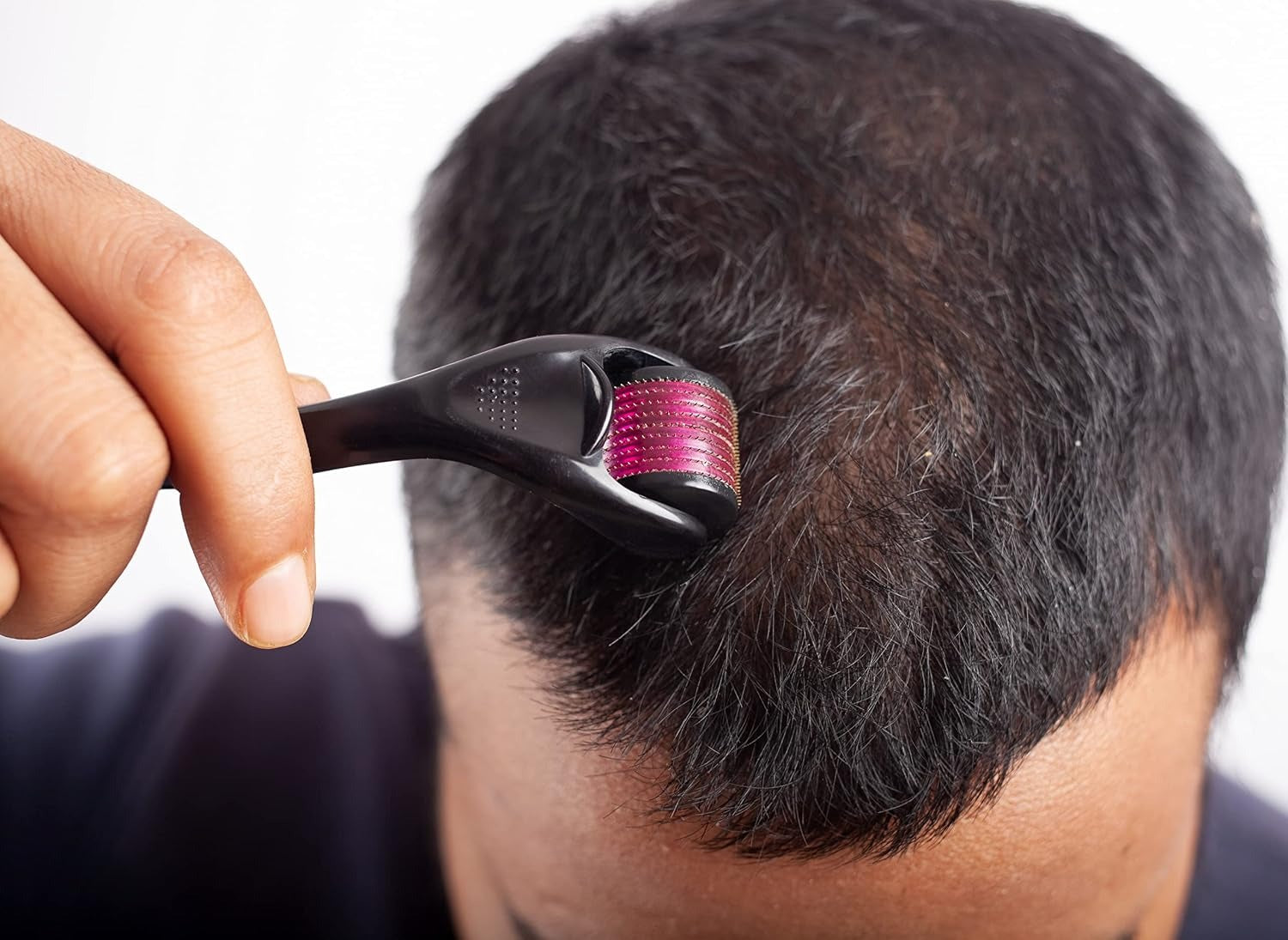 Rullo Viso 540 Micro Aghi 0.5mm – Anti-Rughe, Cellulite e Crescita Capelli